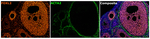 FOXL2 Antibody in Multiplex Immunohistochemistry (mIHC)