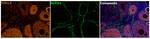 FOXL2 Antibody in Multiplex Immunohistochemistry (mIHC)