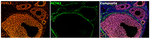 FOXL2 Antibody in Multiplex Immunohistochemistry (mIHC)