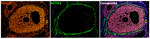 FOXL2 Antibody in Multiplex Immunohistochemistry (mIHC)