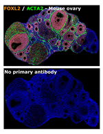 FOXL2 Antibody in Multiplex Immunohistochemistry (mIHC)