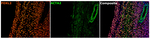 FOXL2 Antibody in Multiplex Immunohistochemistry (mIHC)