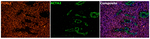 FOXL2 Antibody in Multiplex Immunohistochemistry (mIHC)