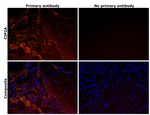 CIP2A Antibody in Immunohistochemistry (IHC)