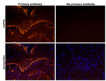 CIP2A Antibody in Immunohistochemistry (IHC)