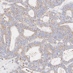 CIP2A Antibody in Immunohistochemistry (Paraffin) (IHC (P))