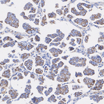 CIP2A Recombinant Rabbit Monoclonal Antibody (PSH16-11)