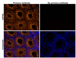 CIP2A Antibody in Immunohistochemistry (IHC)