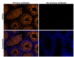 CIP2A Antibody in Immunohistochemistry (IHC)
