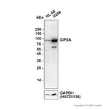 CIP2A Antibody in Western Blot (WB)