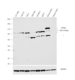 CIP2A Antibody in Western Blot (WB)