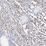 Granzyme K Antibody in Immunohistochemistry (Paraffin) (IHC (P))