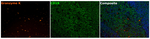 Granzyme K Antibody in Multiplex Immunohistochemistry (mIHC)