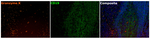 Granzyme K Antibody in Multiplex Immunohistochemistry (mIHC)