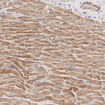 CTGF Antibody in Immunohistochemistry (Paraffin) (IHC (P))
