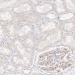 CTGF Antibody in Immunohistochemistry (Paraffin) (IHC (P))