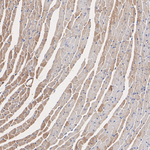 CTGF Antibody in Immunohistochemistry (Paraffin) (IHC (P))