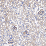 CTGF Antibody in Immunohistochemistry (Paraffin) (IHC (P))
