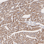 CTGF Antibody in Immunohistochemistry (Paraffin) (IHC (P))