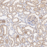 CTGF Antibody in Immunohistochemistry (Paraffin) (IHC (P))