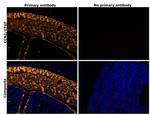 CTGF Antibody in Immunohistochemistry (Paraffin) (IHC (P))