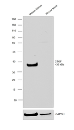 CTGF Antibody