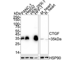CTGF Antibody in Western Blot (WB)