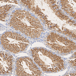Centrin 1 Antibody in Immunohistochemistry (Paraffin) (IHC (P))