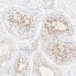Centrin 1 Antibody in Immunohistochemistry (Paraffin) (IHC (P))