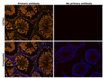 Centrin 1 Antibody in Immunohistochemistry (Paraffin) (IHC (P))