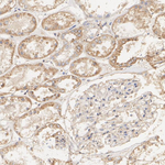 TYK2 Antibody in Immunohistochemistry (Paraffin) (IHC (P))