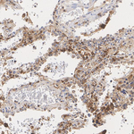 TYK2 Antibody in Immunohistochemistry (Paraffin) (IHC (P))