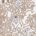 TYK2 Antibody in Immunohistochemistry (Paraffin) (IHC (P))