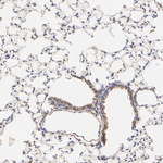 TYK2 Antibody in Immunohistochemistry (Paraffin) (IHC (P))