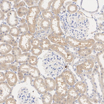 TYK2 Antibody in Immunohistochemistry (Paraffin) (IHC (P))