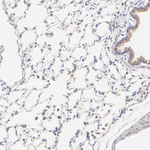 TYK2 Antibody in Immunohistochemistry (Paraffin) (IHC (P))