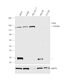TYK2 Antibody