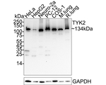 TYK2 Antibody in Western Blot (WB)