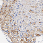 CHRNA7 Antibody in Immunohistochemistry (Paraffin) (IHC (P))