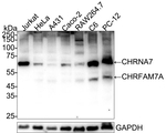 CHRNA7 Antibody in Western Blot (WB)