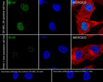 SLUG Recombinant Rabbit Monoclonal Antibody (PSH07-40)