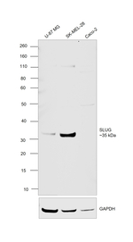 SLUG Antibody in Western Blot (WB)