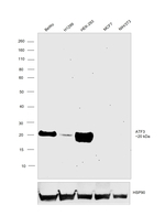 ATF3 Recombinant Rabbit Monoclonal Antibody (PSH17-99)