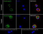 Amphiregulin Recombinant Rabbit Monoclonal Antibody (PSH19-73)