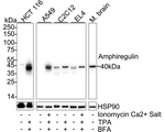 Amphiregulin Antibody in Western Blot (WB)