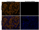 AKR1B10 Antibody in Immunohistochemistry (Paraffin) (IHC (P))