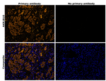 AKR1B10 Antibody in Immunohistochemistry (Paraffin) (IHC (P))