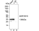 AKR1B10 Antibody in Immunoprecipitation (IP)