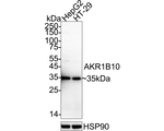 AKR1B10 Antibody in Western Blot (WB)