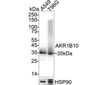 AKR1B10 Antibody in Western Blot (WB)